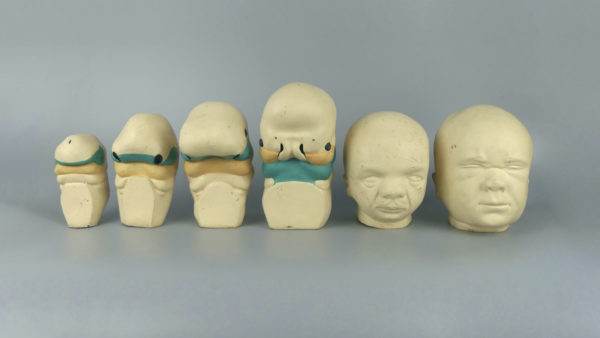 Modèles d'anatomie 6 têtes fœtales