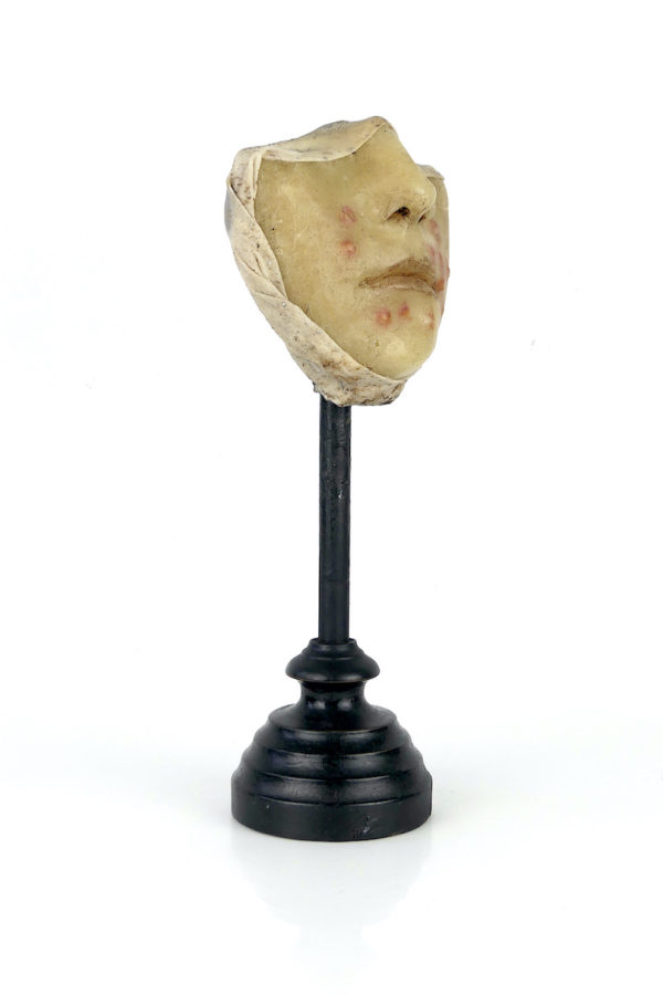 Céroplastie herpès du visage en cire sur pied (3/4)