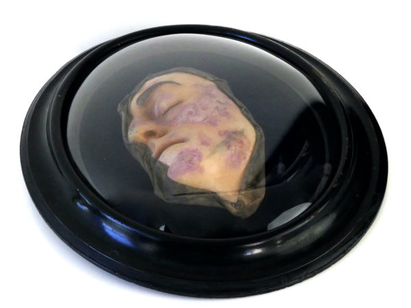 Visage de lépreux en cire sous verre bombé Napoléon III Céroplastie (3/4)