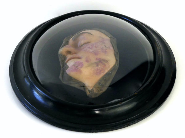 Visage de lépreux en cire sous verre bombé Napoléon III Céroplastie (dessous 3/4)