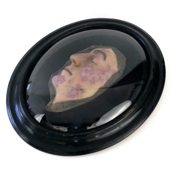 Visage de lépreux en cire sous verre bombé Napoléon III Céroplastie (3/4)