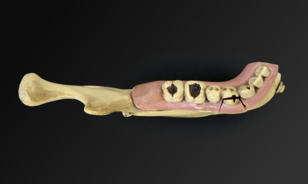 Modèle hémi-mandibule humaine en pyralène 1900 Allemagne (dessus)