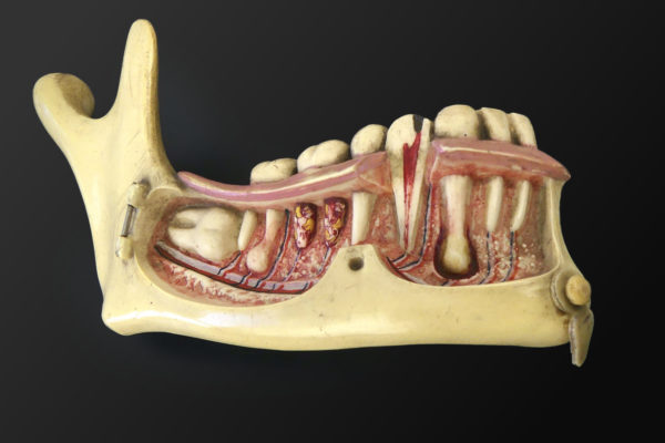 Modèle hémi-mandibule humaine en pyralène 1900 Allemagne (ouvert)