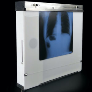 Grand négatoscope vintage tableau mural lumineux Pologne Radiologie (3/4)