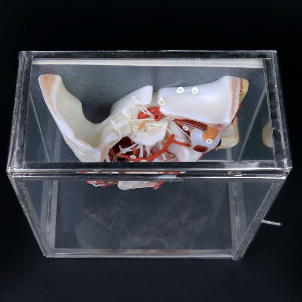 Ecorché en cire SOMSO rare demi-tête humaine dans sa vitrine de verre Allemagne (dessus 3/4)