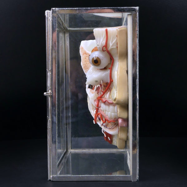 Ecorché en cire SOMSO rare demi-tête humaine dans sa vitrine de verre Allemagne (profil)