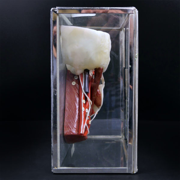 Ecorché en cire SOMSO rare demi-tête humaine dans sa vitrine de verre Allemagne (profil)