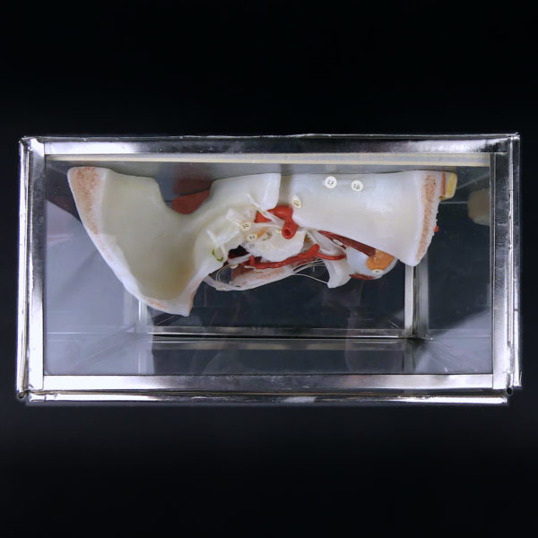 Ecorché en cire SOMSO rare demi-tête humaine dans sa vitrine de verre Allemagne (dessus)