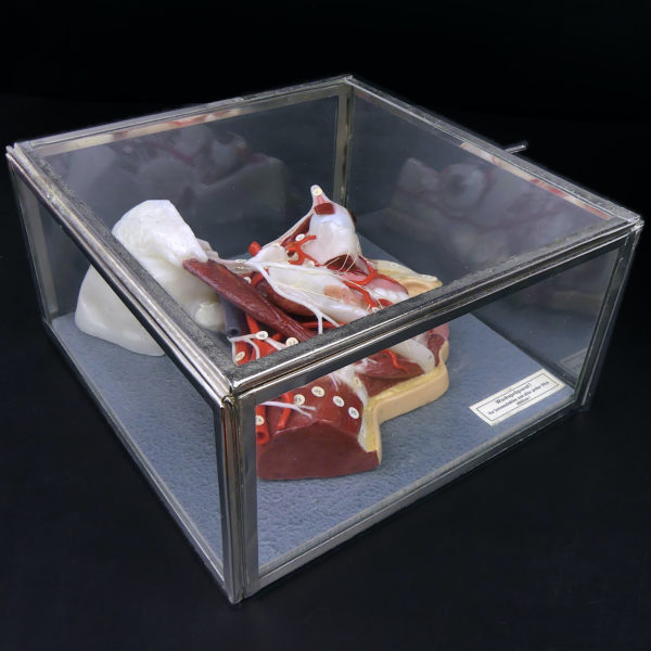 Ecorché en cire SOMSO rare demi-tête humaine dans sa vitrine de verre Allemagne (dessous 3/4)