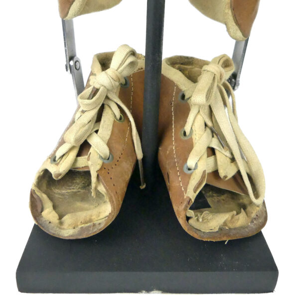 Paire orthèses orthopédiques infantiles de jambes en cuir moulé sur socle (détail)