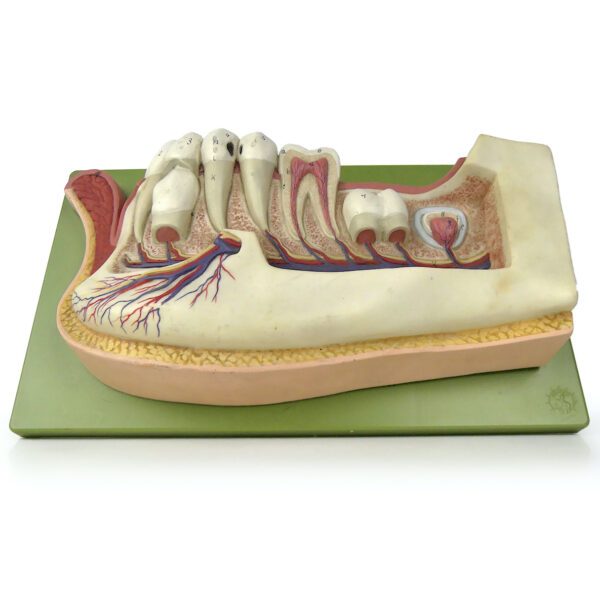 Mandibule d'enfant de 12 ans didactique SOMSO sur socle Allemagne (dessous 3/4)