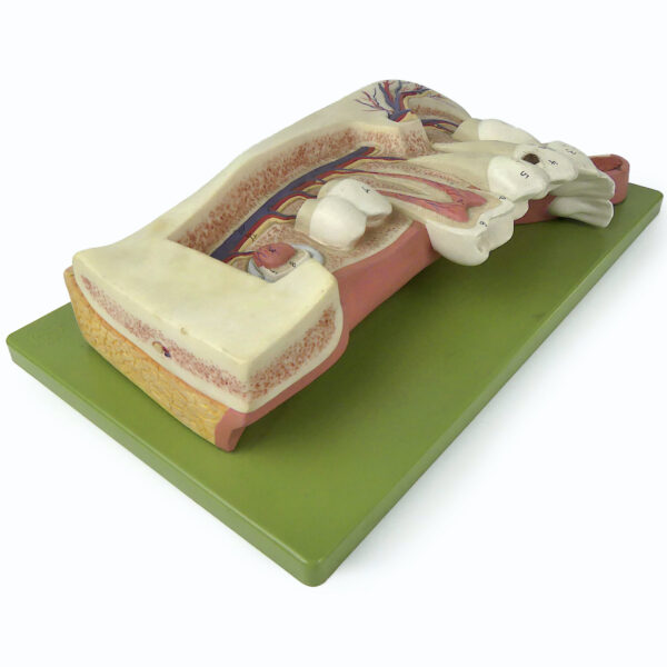 Mandibule d'enfant de 12 ans didactique SOMSO sur socle Allemagne (dessus 3/4)