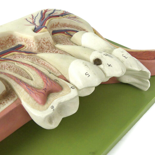 Mandibule d'enfant de 12 ans didactique SOMSO sur socle Allemagne (détail)