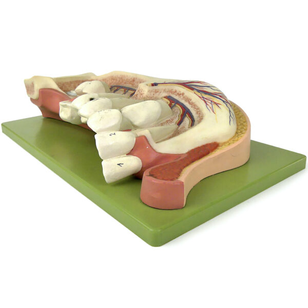 Mandibule d'enfant de 12 ans didactique SOMSO sur socle Allemagne (dessus 3/4)
