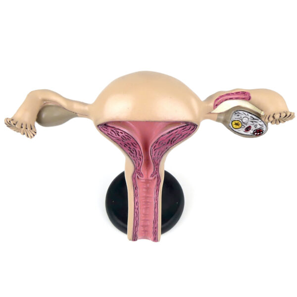 Système reproducteur féminin modèle pédagogique allemand Etler Zimmer (dessus)